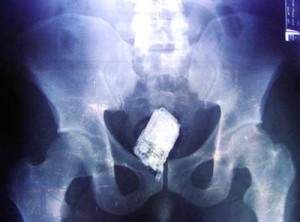 Homem_pistola_celular_ânus_blog_do_Tom