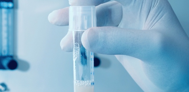 espermatozoide-laboratorio-