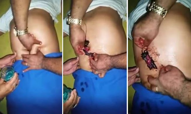 RATO BARRIGA