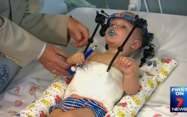 CRIANÇA COM O CRÂNIO PARTIDO