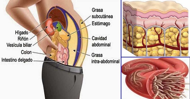 cha_seca-barriga_-_novo